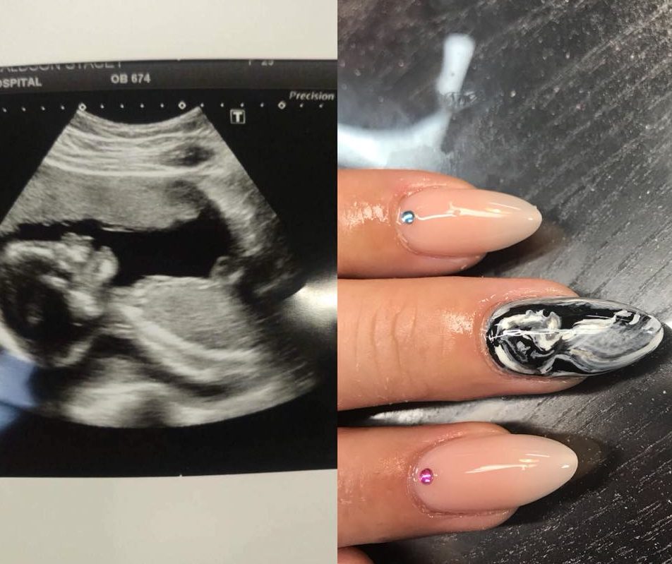 Trend Women Are Announcing Their Pregnancy In Sonogram Nail Art